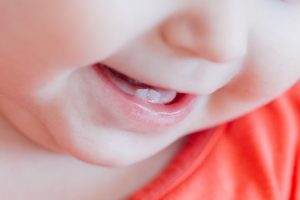 درد ناشی از دندان درآوردن کودکان