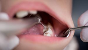 دندان درد کودک