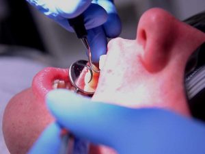 خطرات سلامت دهان و دندان کودکان
