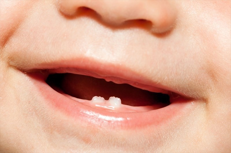 مشکلات حین رویش دندان در کودکان