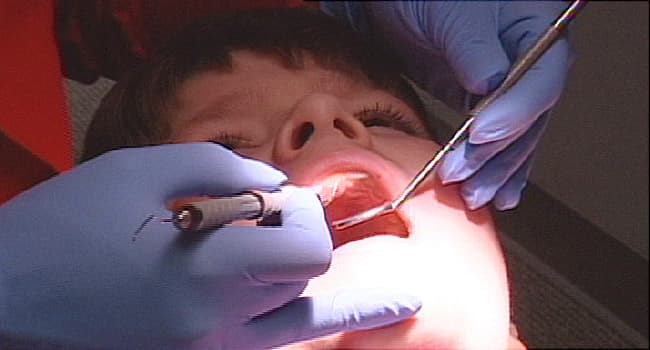 مراقبت از دندان کودکان در کرونا