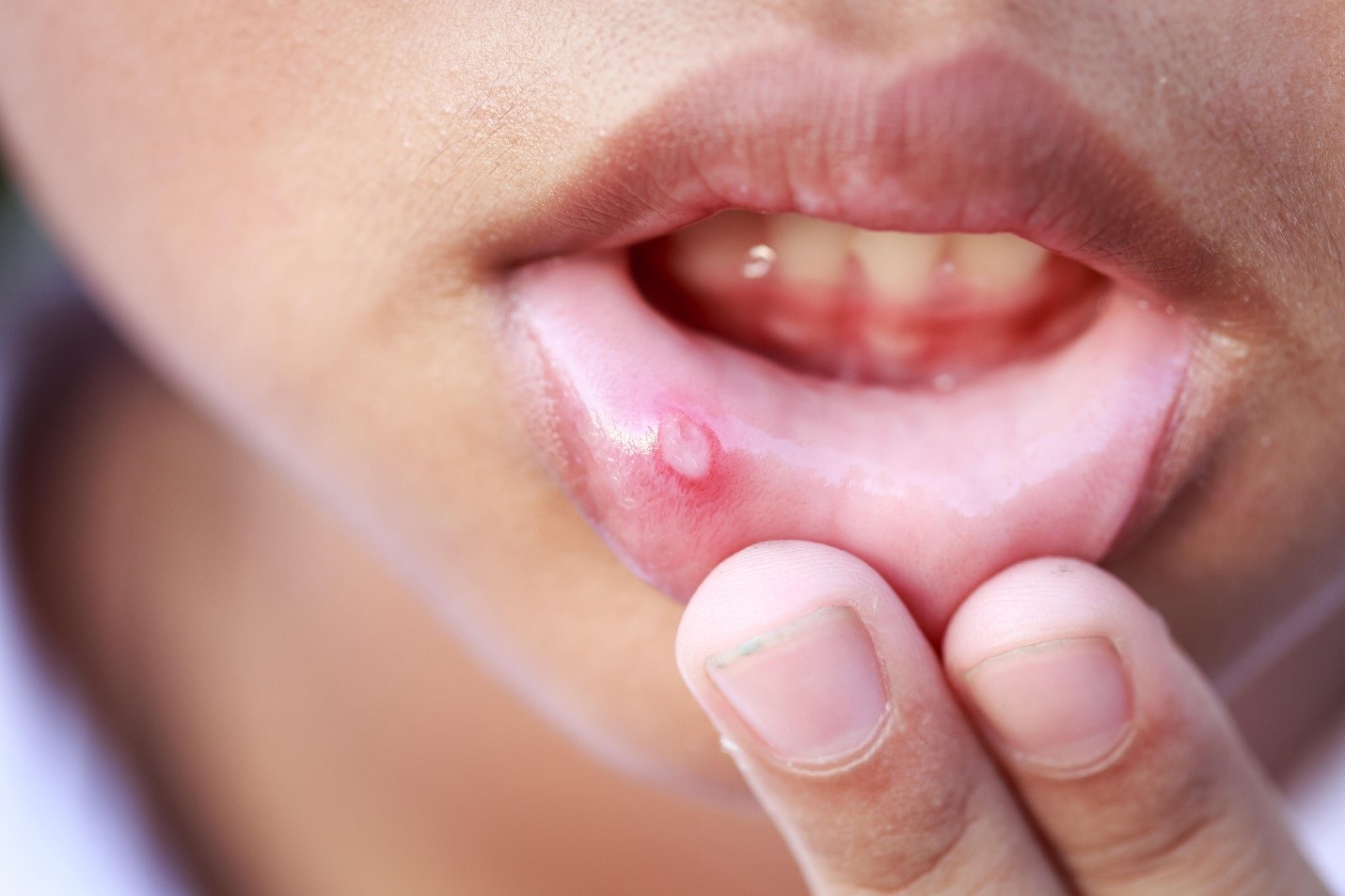 تأثیر داروها بر سلامت دهان کودکان