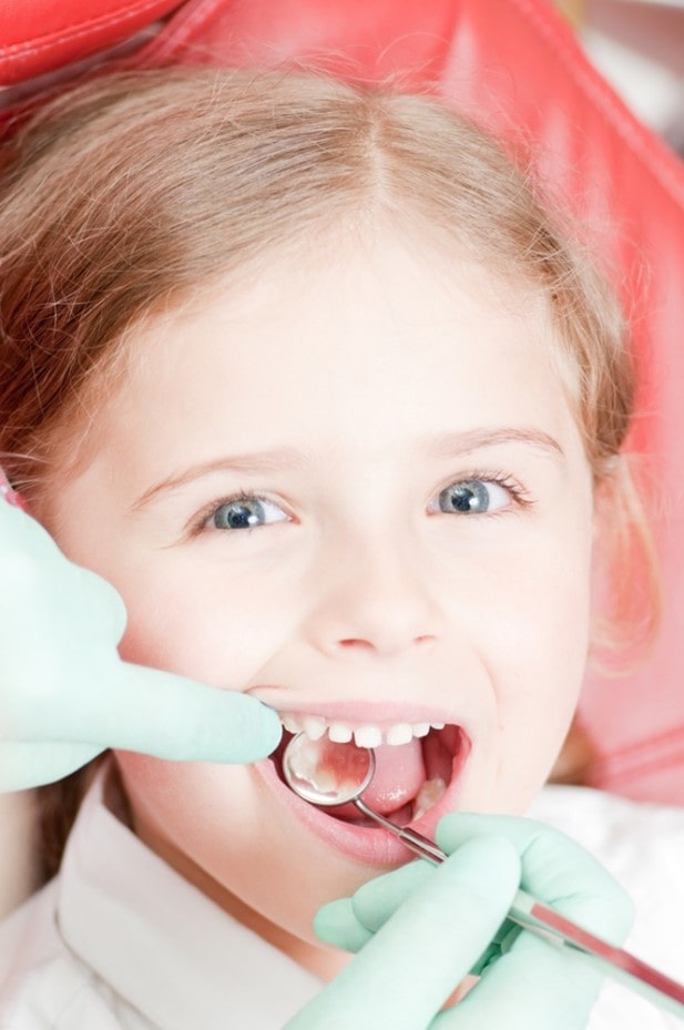 مزایا و معایب کشیدن دندان شیری